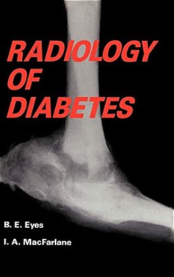 Radiology Of Diabetes-..