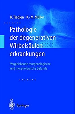 Pathologie Der Degenerativen Wirbelsäulenerkrankungen: Vergleichende Röntgenologische Und Morphologische Befunde-..