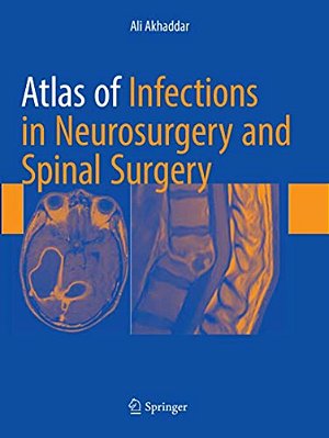 Atlas Of Infections In Neurosurgery And Spinal Surgery-..