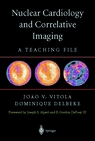 Nuclear Cardiology And Correlative Imaging: A Teaching File-..