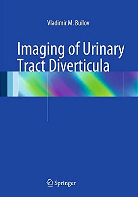 Imaging Of Urinary Tract Diverticula-..