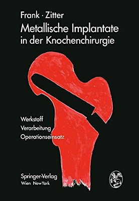 Metallische Implantate In Der Knochenchirurgie: Werkstoff - Verarbeitung, Operationseinsatz-..