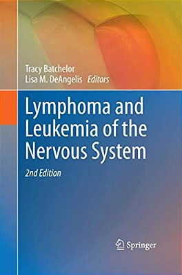 Lymphoma And Leukemia Of The Nervous System-..