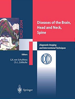 Diseases Of The Brain, Head And Neck, Spine: Diagnostic Imaging And Interventional Techniques-..