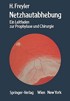 Netzhautabhebung: Ein Leitfaden Zur Prophylaxe Und Chirurgie-..