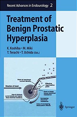 Treatment Of Benign Prostatic Hyperplasia-..