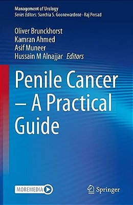 Penile Cancer - A Practical Guide-..