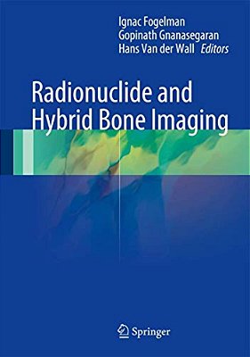 Radionuclide And Hybrid Bone Imaging-..