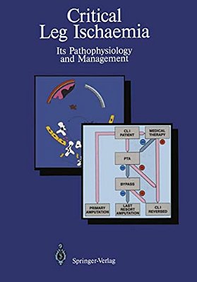 Critical Leg Ischaemia: Its Pathophysiology And Management-..