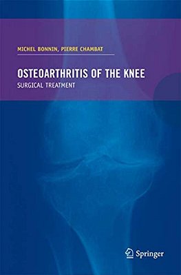 Osteoarthritis Of The Knee-..