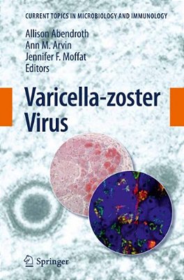 Varicella-Zoster Virus-..
