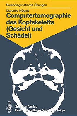 Computertomographie Des Kopfskeletts (Gesicht Und Schädel): 58 Diagnostische Übungen Für Studenten Und Praktische Radiologen-..
