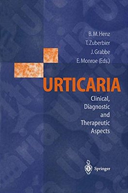 Urticaria: Clinical, Diagnostic And Therapeutic Aspects-..