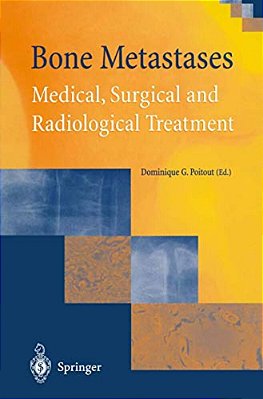 Bone Metastases: Medical, Surgical And Radiological Treatment-..