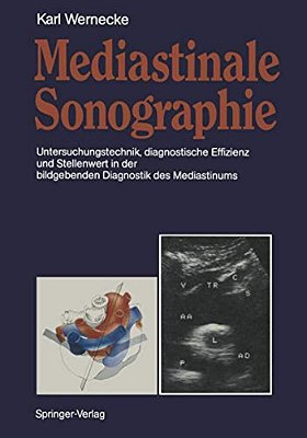 Mediastinale Sonographie: Untersuchungstechnik, Diagnostische Effizienz Und Stellenwert In Der Bildgebenden Diagnostik Des Mediastinums-..