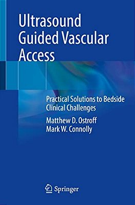 Ultrasound Guided Vascular Access: Practical Solutions To Bedside Clinical Challenges-..