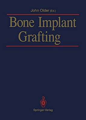 Bone Implant Grafting-..