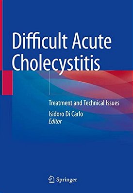 Difficult Acute Cholecystitis: Treatment And Technical Issues-..