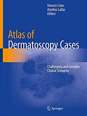 Atlas Of Dermatoscopy Cases: Challenging And Complex Clinical Scenarios-..