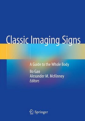 Classic Imaging Signs: A Guide To The Whole Body-..