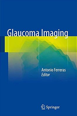 Glaucoma Imaging-..