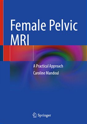 Female Pelvic Mri: A Practical Approach-..