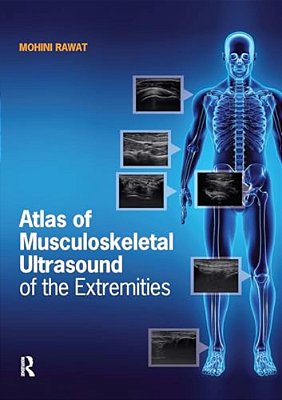 Atlas Of Musculoskeletal Ultrasound Of The Extremities-..
