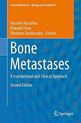 Bone Metastases: A Translational And Clinical Approach-..