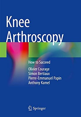 Knee Arthroscopy: How To Succeed-..