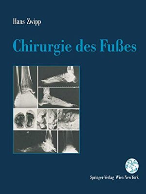Chirurgie Des Fußes-..