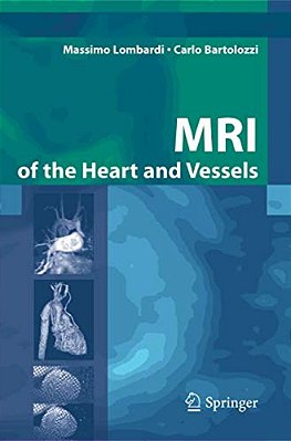 Mri Of The Heart And Vessels-..