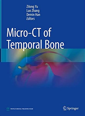 Micro-Ct Of Temporal Bone-..