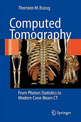 Computed Tomography: From Photon Statistics To Modern Cone-Beam Ct-..