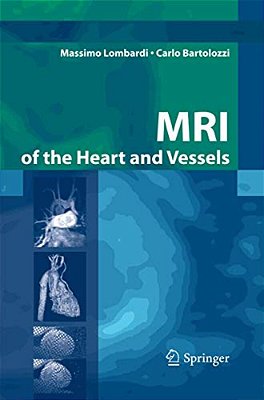 Mri Of The Heart And Vessels-..