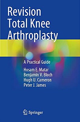Revision Total Knee Arthroplasty: A Practical Guide-..