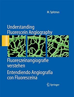 Understanding Fluorescein Angiography, Fluoreszeinangiografie Verstehen, Entendiendo Angiografía Con Fluoresceína-..