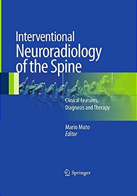 Interventional Neuroradiology Of The Spine: Clinical Features, Diagnosis And Therapy-..