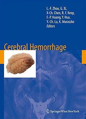 Cerebral Hemorrhage-..