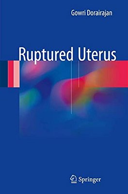 Ruptured Uterus-..