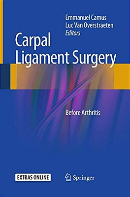 Carpal Ligament Surgery: Before Arthritis-..