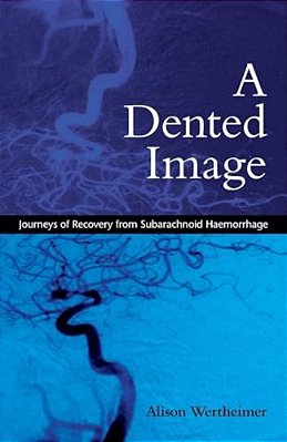 A Dented Image: Journeys Of Recovery From Subarachnoid Haemorrhage-..