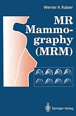 Mr Mammography (Mrm)-..