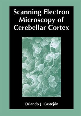 Scanning Electron Microscopy Of Cerebellar Cortex-..