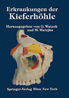 Erkrankungen Der Kieferhöhle: Symposium, Fuschl, 26.-29. September 1985-..