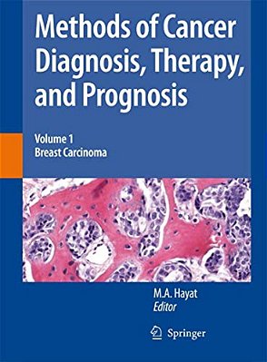 Methods Of Cancer Diagnosis, Therapy And Prognosis: Breast Carcinoma-..