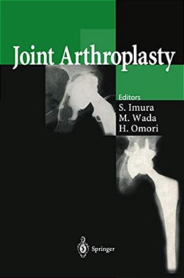 Joint Arthroplasty-..