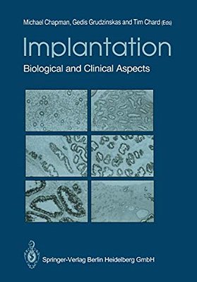 Implantation: Biological And Clinical Aspects-..