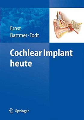 Cochlear Implant Heute-..
