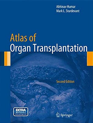 Atlas Of Organ Transplantation-..