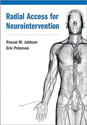 Radial Access For Neurointervention-..